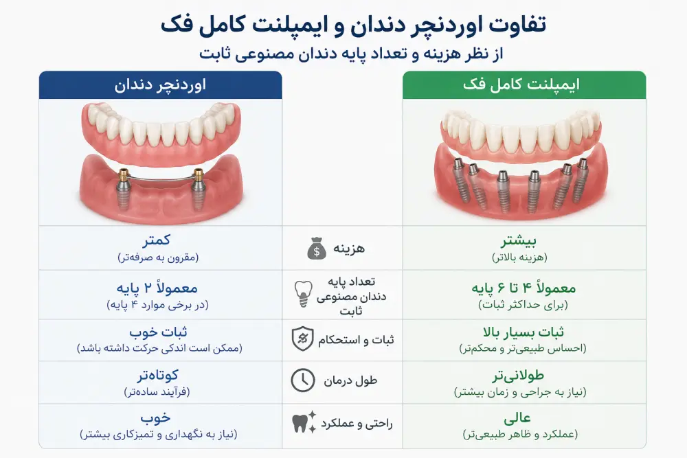 تفاوت اوردنچر دندان و ایمپلنت کامل فک از نظر هزینه و تعداد پایه دندان مصنوعی ثابت