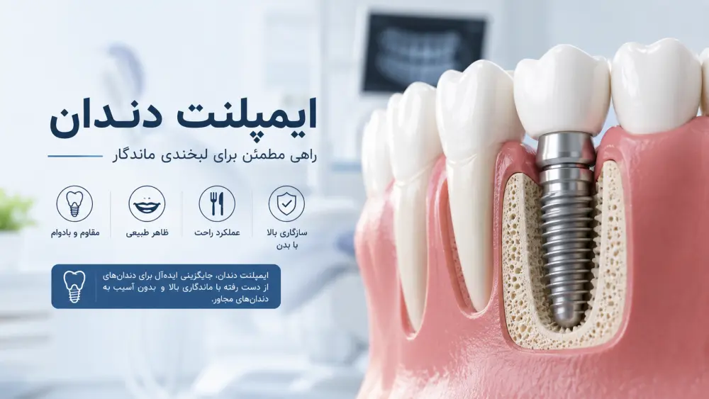 کاشت ایمپلنت دندان اقساطی در کلینیک طرف قرارداد سلامت پویا